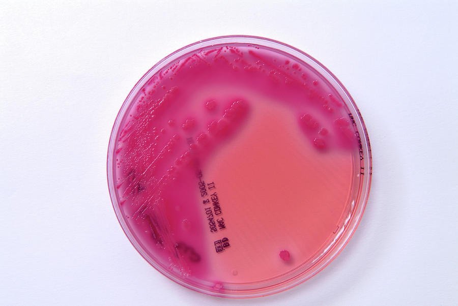 E. coli bacterial culture